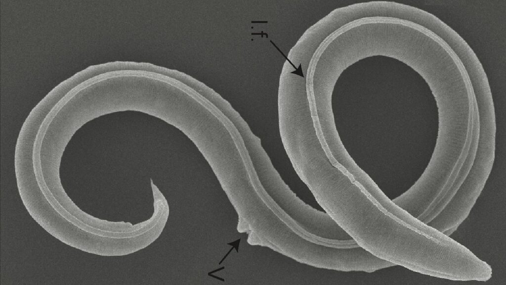 Skynews Worm Frozen Siberian 6232712 1024x576